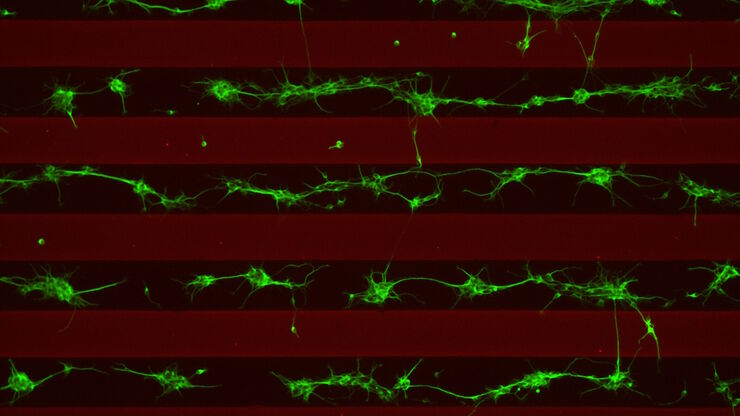 Stripe assay performed on a THUNDER Imager Cell. Courtesy of Maria Carrasquero Ordaz, University of Oxford. Stripe assay performed on a THUNDER Imager Cell. Courtesy of Maria Carrasquero Ordaz, University of Oxford.